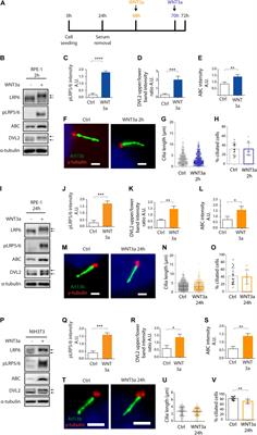 Primary Cilia Formation Does Not Rely on WNT/β-Catenin Signaling